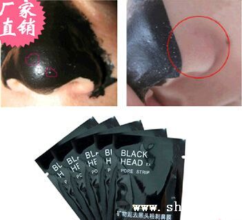 科學(xué)祛除粉刺黑頭 解析鼻貼與礦物泥的神奇效果